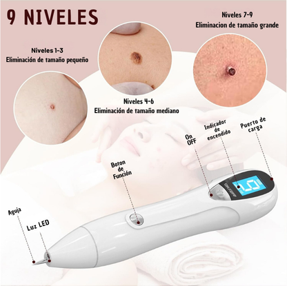 Pluma Plasma Pen Quita Verruga Y Pecas
